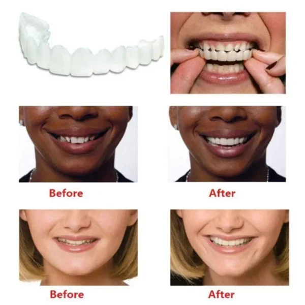 Fake Tooth Cover Perfect Fit Silicone Teeth Whitening Snap On Smile ...